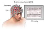 EEG