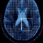 Medical Image Analysis