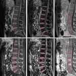 Medical Image Segmentation